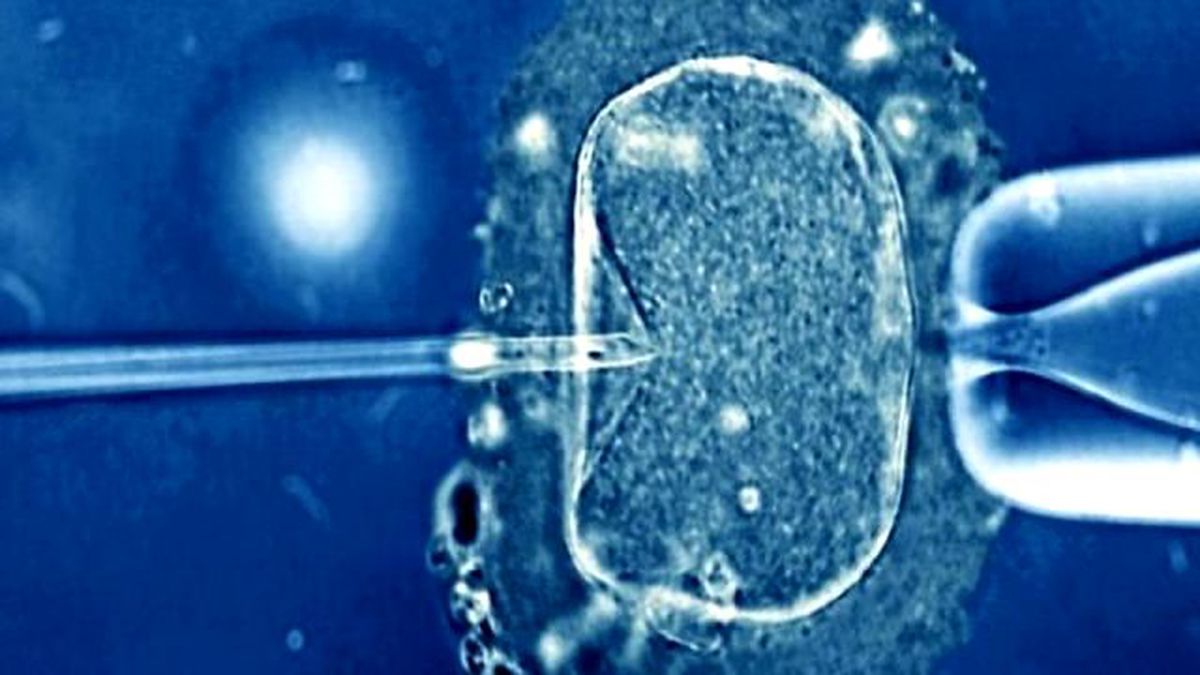 Erkeklerde Kalitesiz Sperm \'Kalıtsal\'