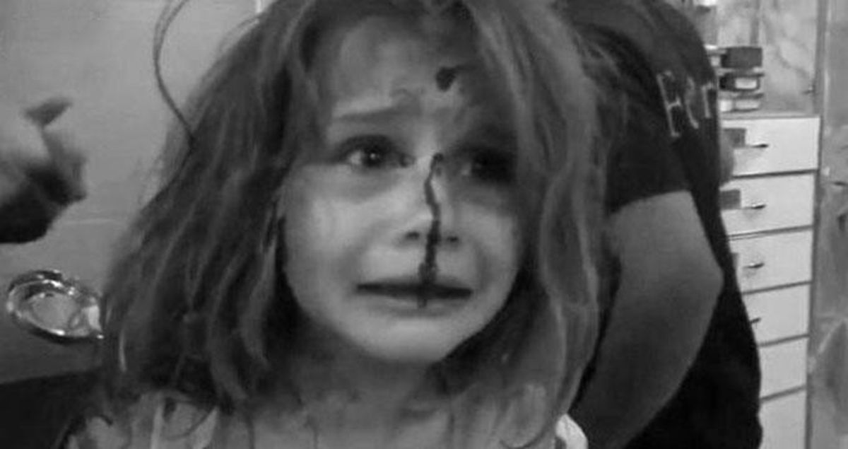 Saldırıda Yaralanan Aya Babasını Gözyaşları İçinde Aradı