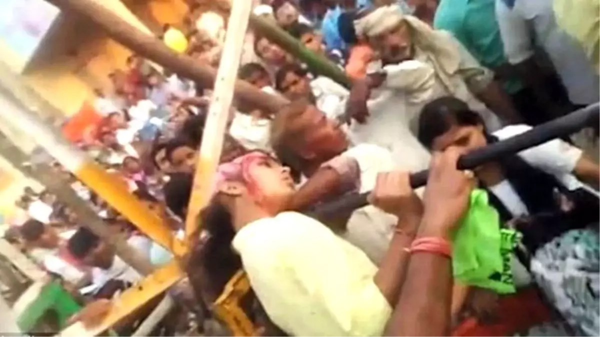 Dönme Dolapta Selfie Çekilen Genç Kızın Kafa Derisi Yüzüldü