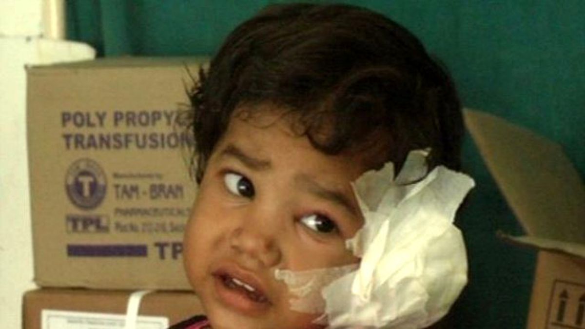 Küçük Kızın Kulağından 80 Adet Larva Çıkarıldı