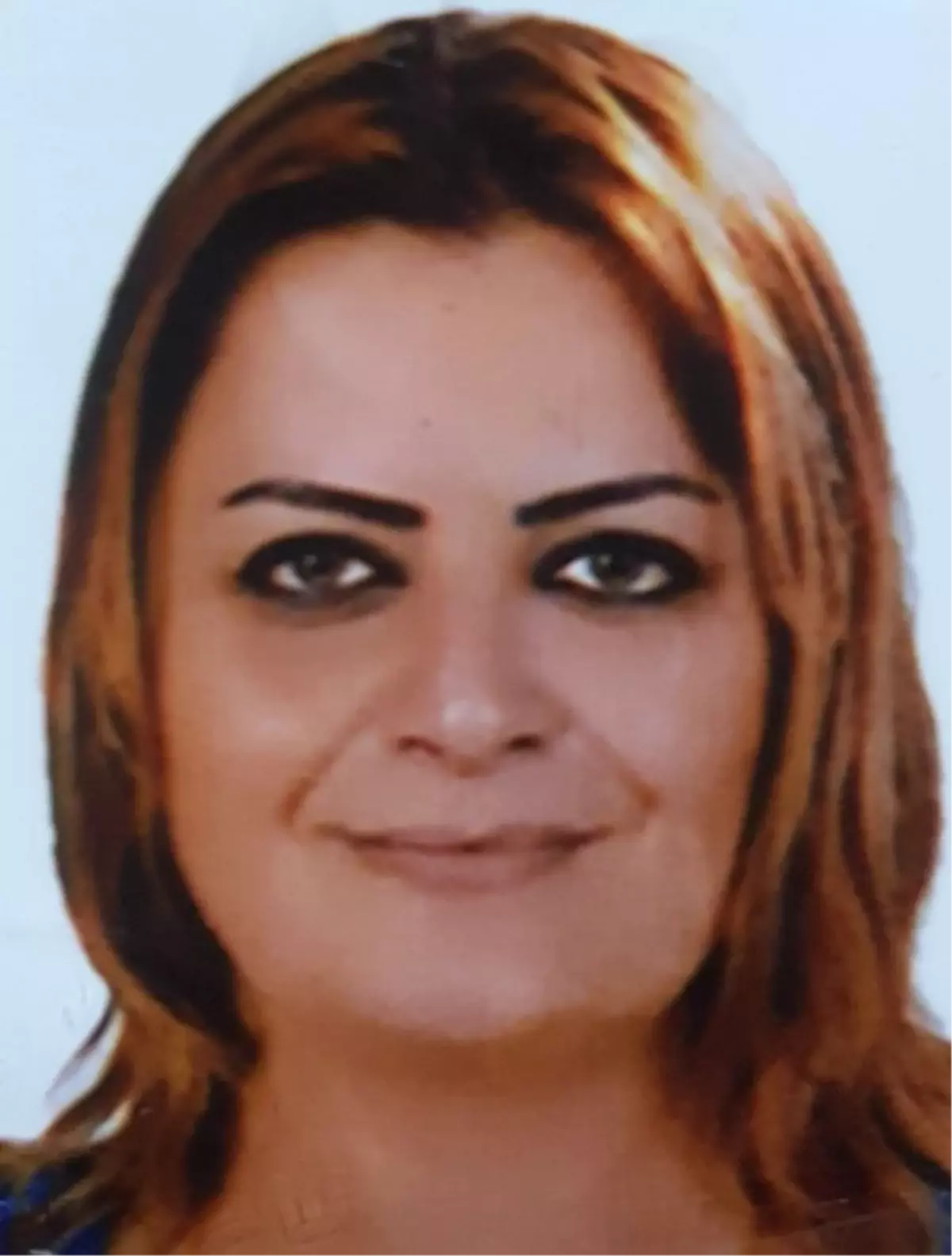 Liposuction Yaptıran Genç Kadın Hayatını Kaybetti