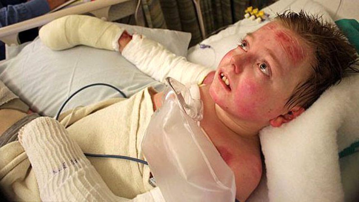 Yaşaması İçin Vücudu Bandajla Sarılıyor