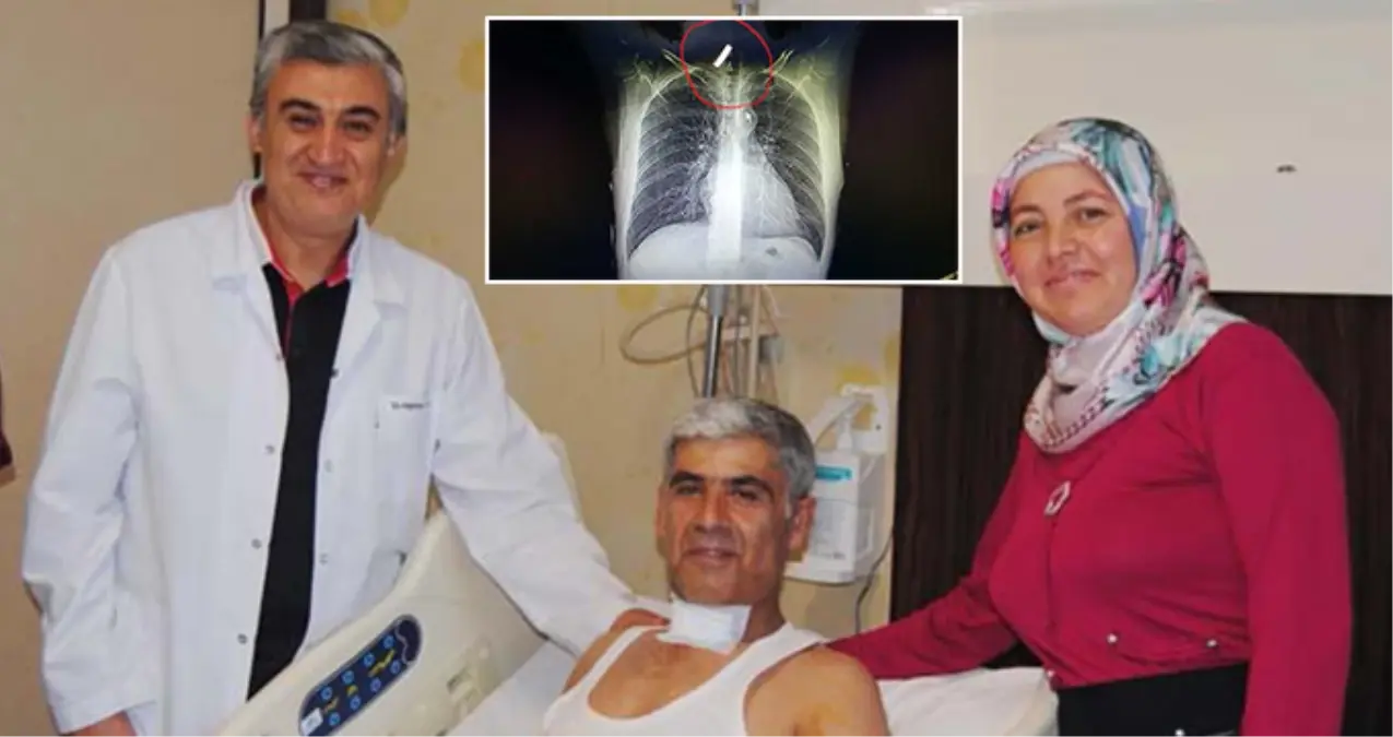 15 Ay Boynunda Demir Parçasıyla Yaşadı!