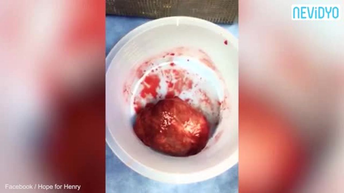 Minik Bebeğin Kalbi Böyle Attı +18