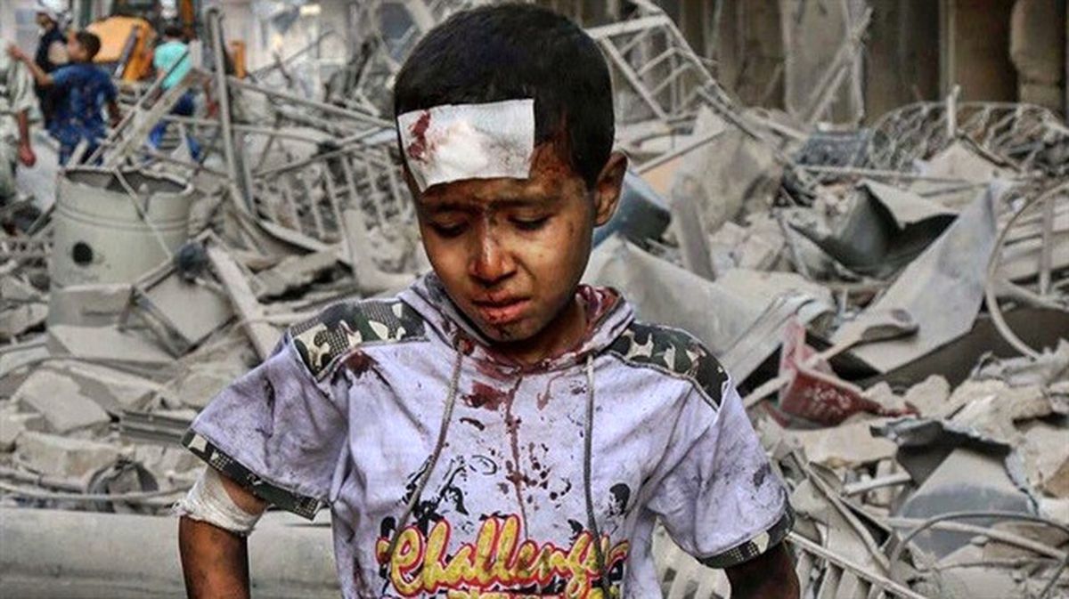 Halep\'te, Her 10 Bin Kişiye 1 Doktor Düşüyor