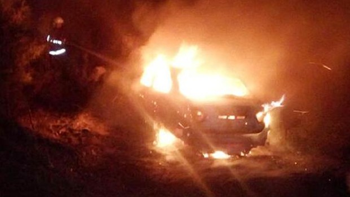 Diş Hekimi, Otomobilini Ateşe Verdi