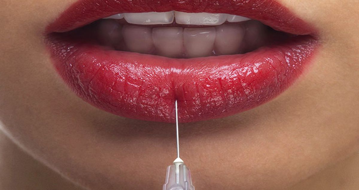 Dudak Dolgusuyla İlgili Çok Bilinen Yanlışlar Düzeltildi