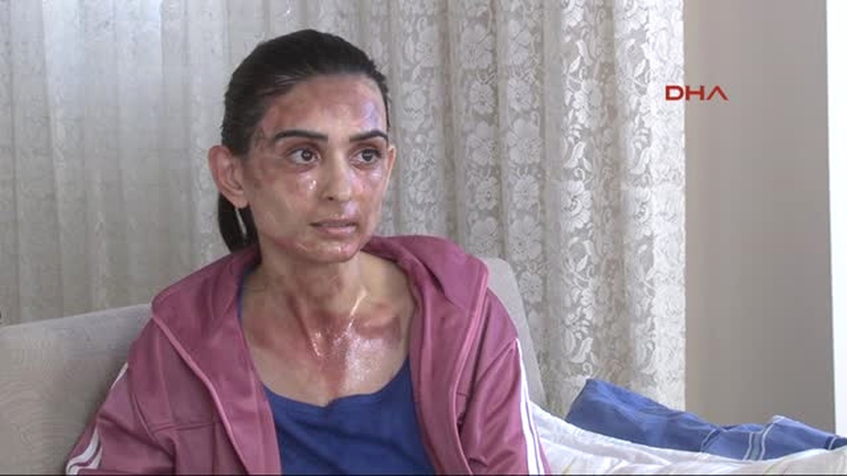 Izmir Aşure Yaptığı Düdüklü Tencere, Bomba Gibi Patladı