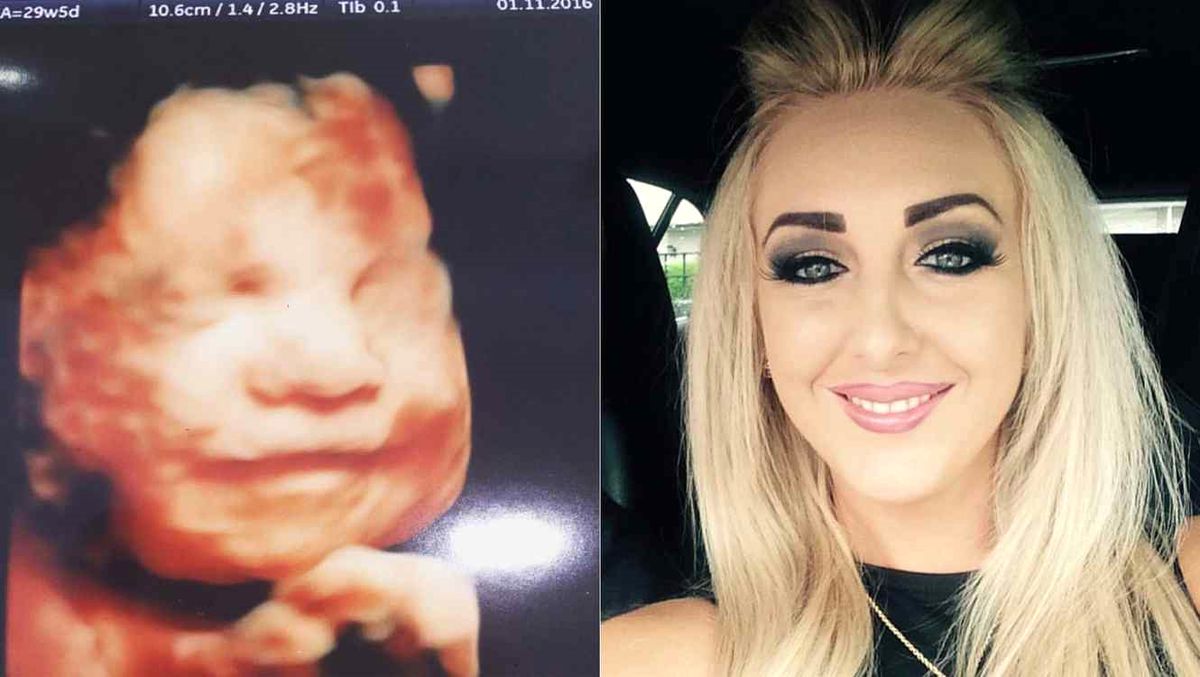 İngiltere'nin En Mutlu Bebeği! Anne Karnında Gülümsüyor