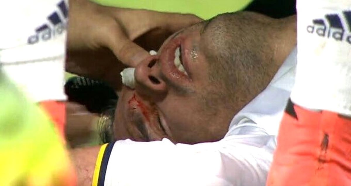 Robin Van Persie, Yüzüne Aldığı Darbe Nedeniyle Sakatlandı ve Oyundan Çıktı