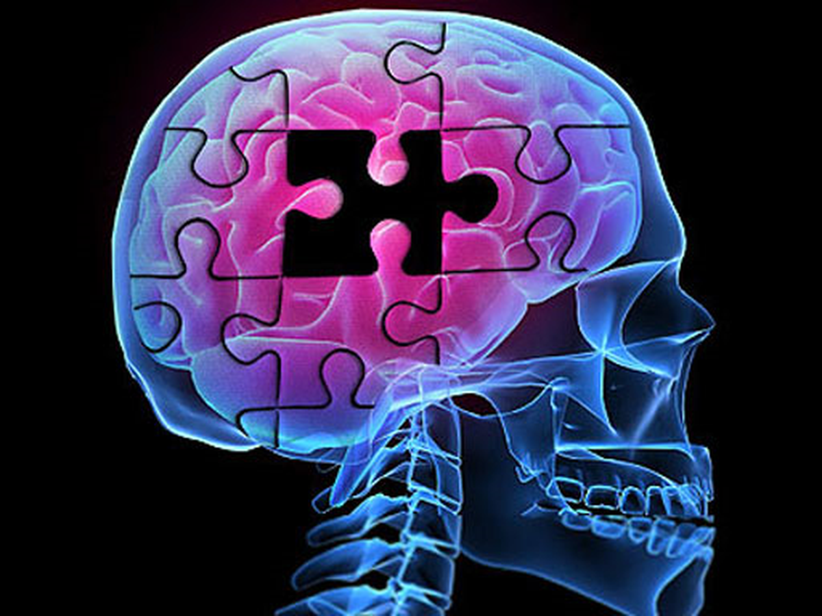 Alzheimer\'ın İlk Belirtisi Kişilik Değişikliği Olabilir