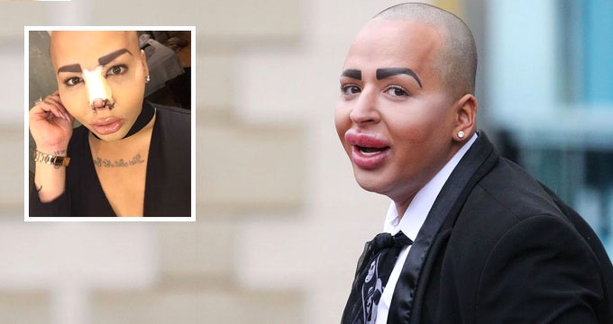 Kardashian'a Benzemek İsteyen Makyöz Ameliyat İçin Türkiye'ye Geldi