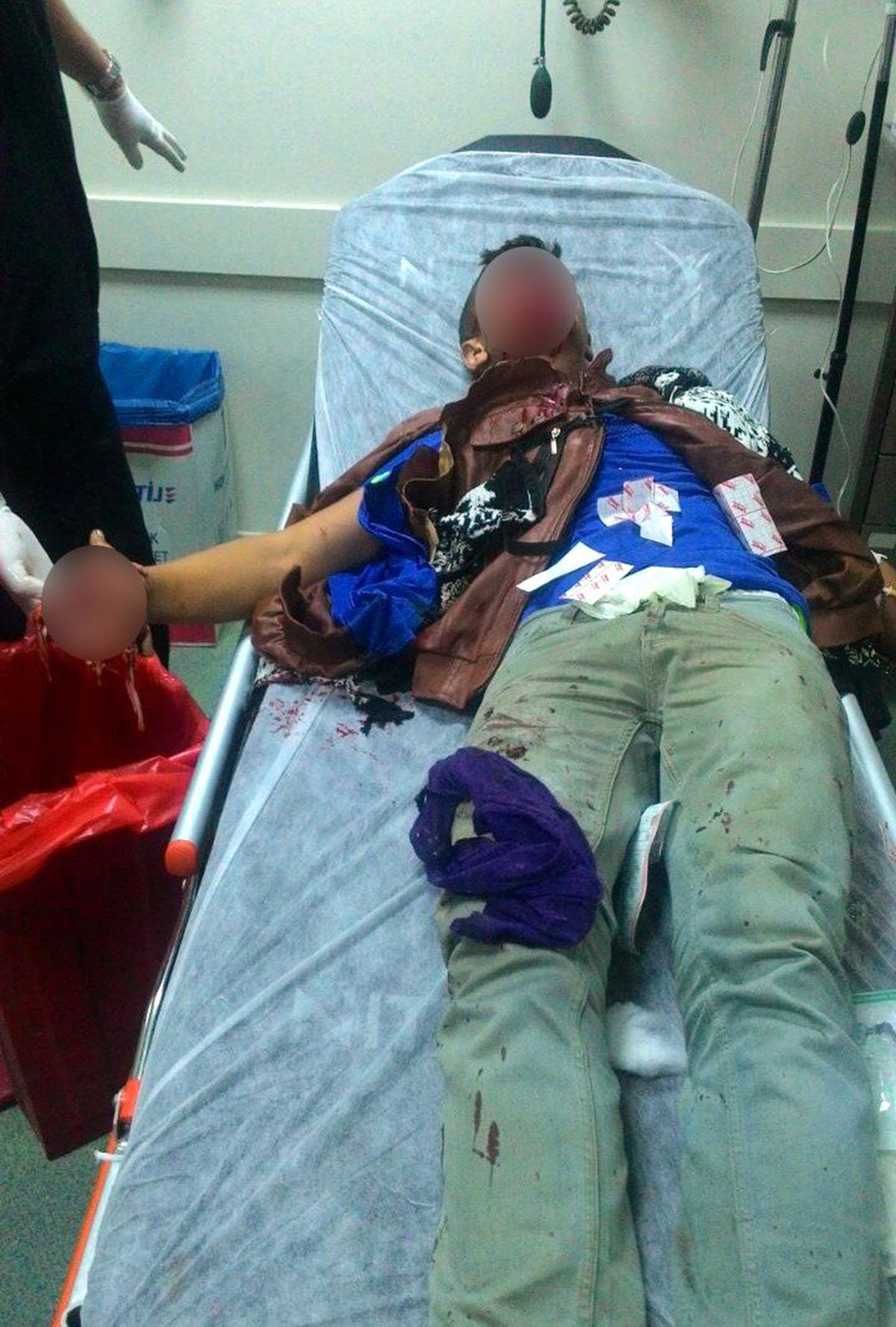 PKK Sempatizanının Polise Atmak İstediği Bomba Elinde Patladı