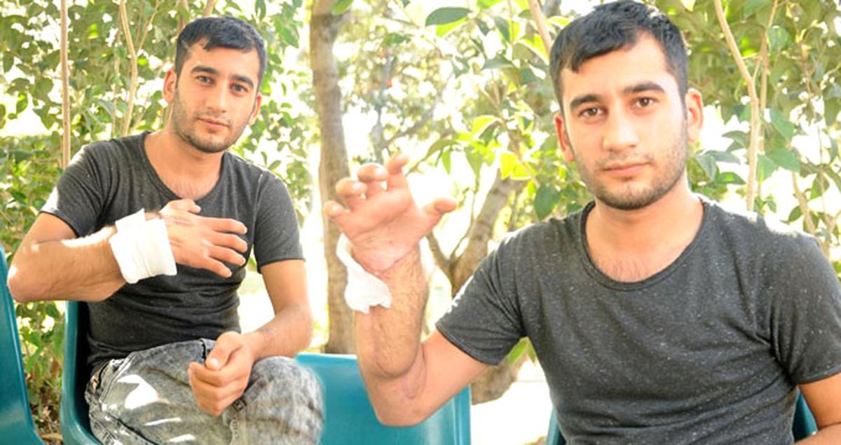 Resmen Mucize! 32 Bin Volt Elektrik Çarptı, Hayatta Kaldı