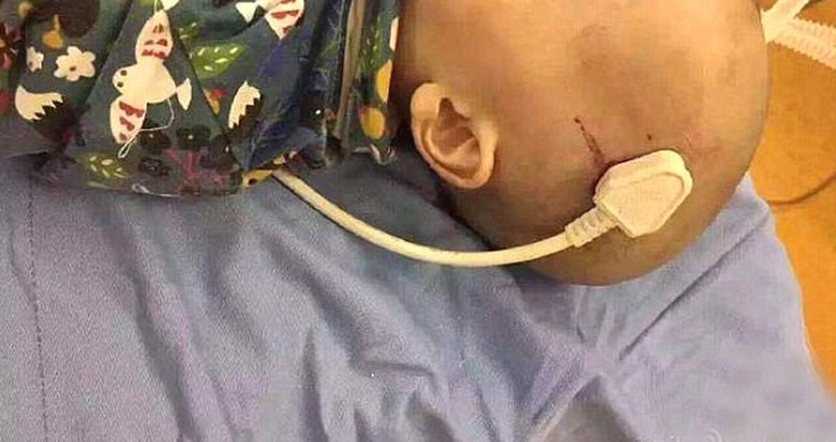 Çinli Bebeğin Beynine Fiş Saplandı