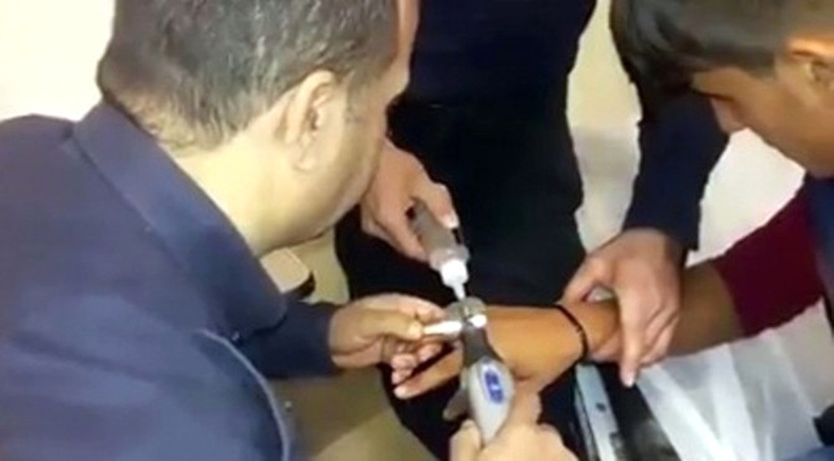 Parmağına Sıkışan Yüzük İtfaiye Tarafından Çıkartıldı