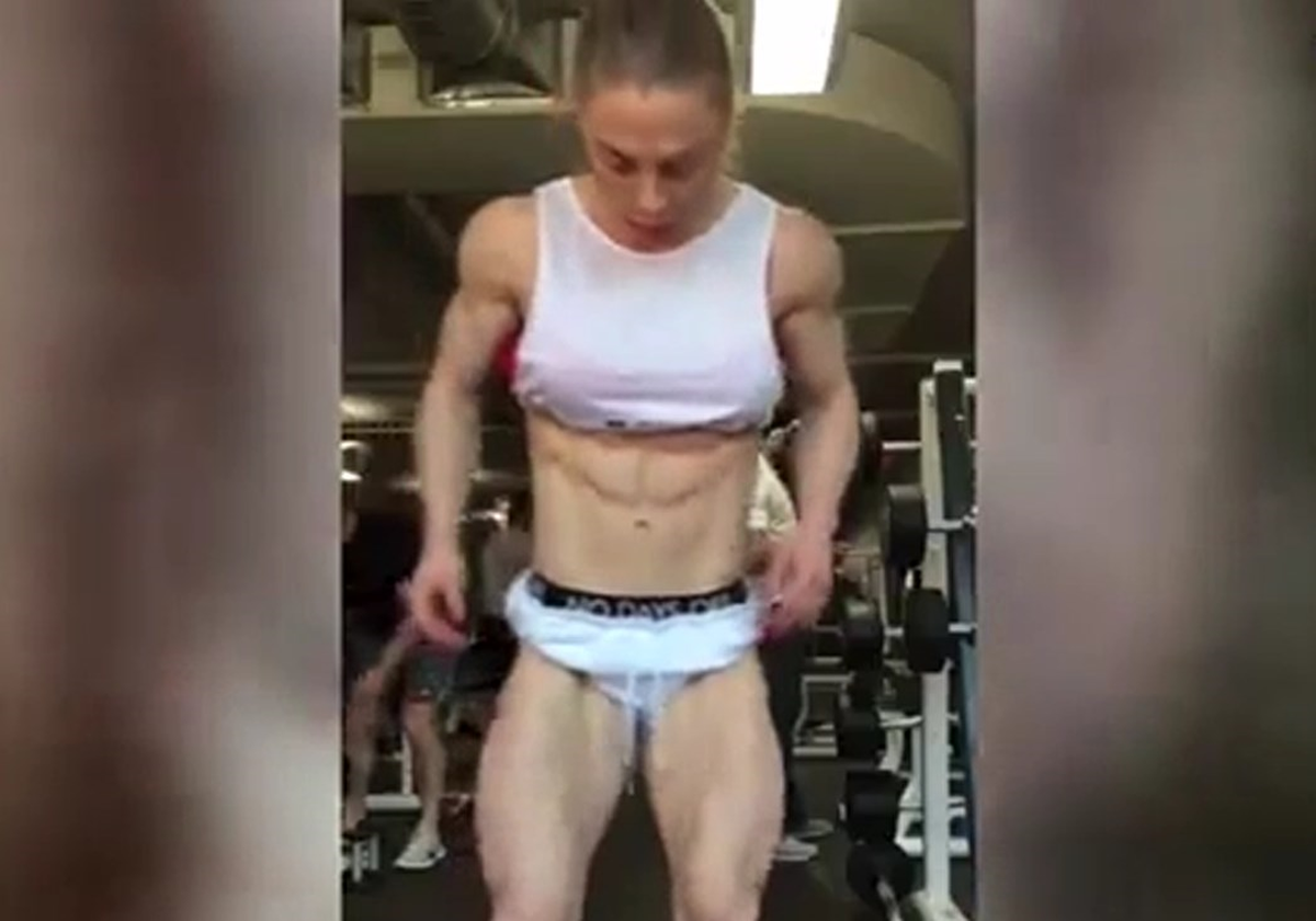 Vücudunda Yağ Bulunmayan Kadın Hayrete Düşürdü