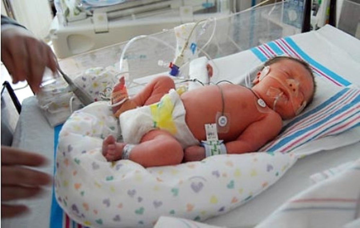 17 Kasım Dünya Prematüre Bebekler Günü