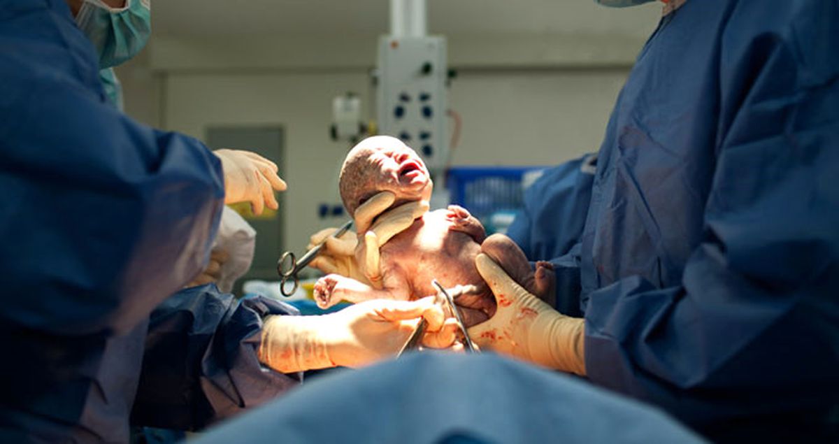 İkiz Bekleyen Kadın, Bebeklerden Birine Hala Hamile