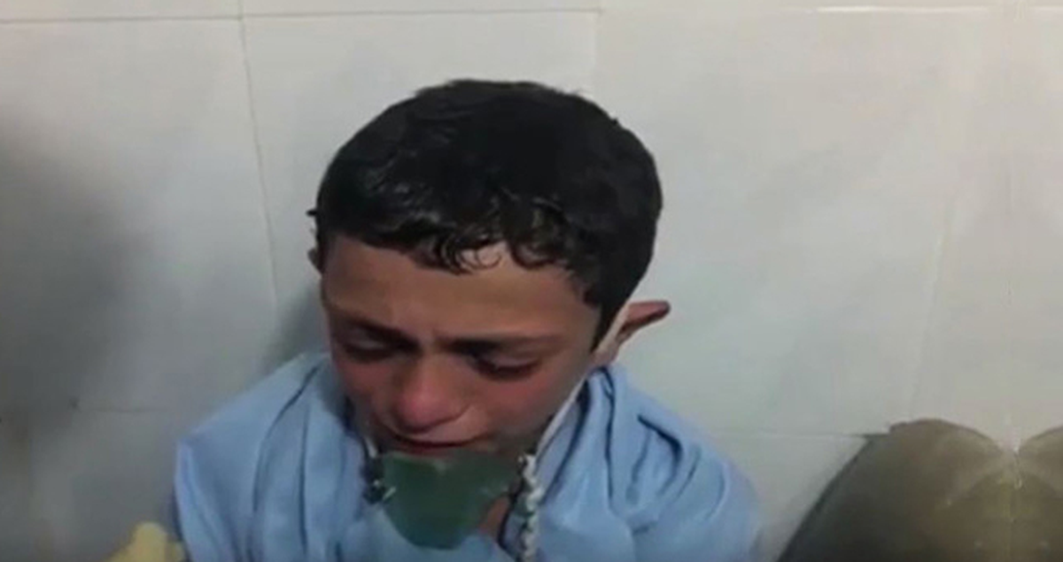 Halep'te Bombardımanda Yaralanan Çocuk: Ölecek Miyim Teyze