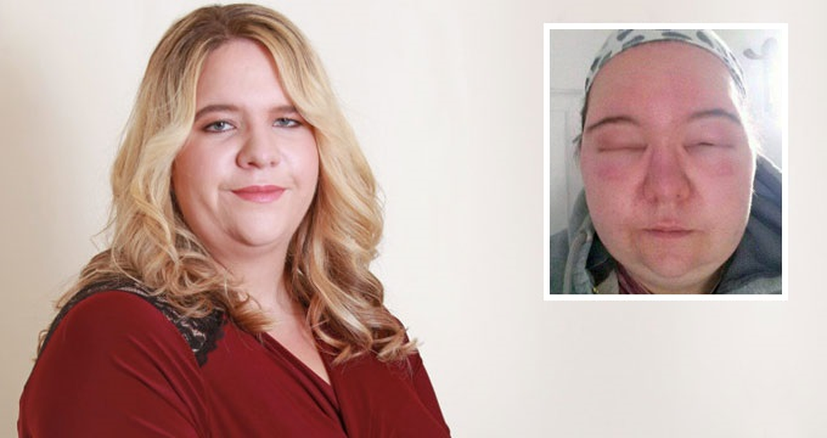 Alerji Testini Yaptırmayan Hamile Kadın Ölümden Döndü