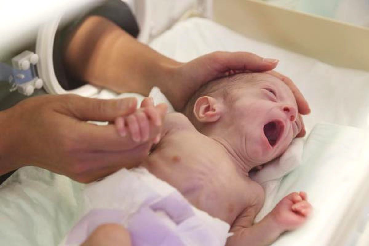 Üçüz Parmak Bebekler Sağlıklarına Kavuştu