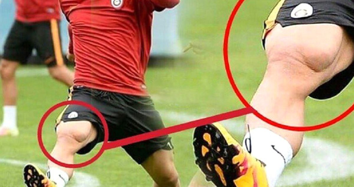 Lukas Podolski, Bacak Kasıyla Sosyal Medyada Hava Attı