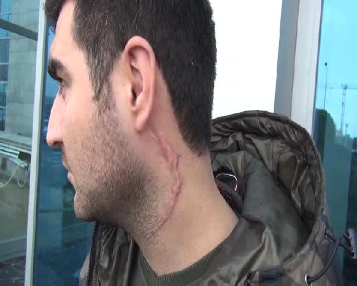 Trafik Tartışmasından "Öldürmeye Teşebbüs" Davasına