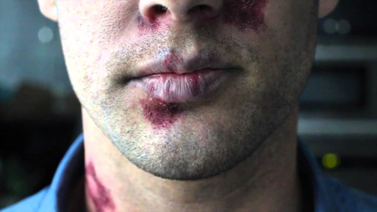 14 Milyon İnsan HIV Virüsü Taşıdığından Habersiz!