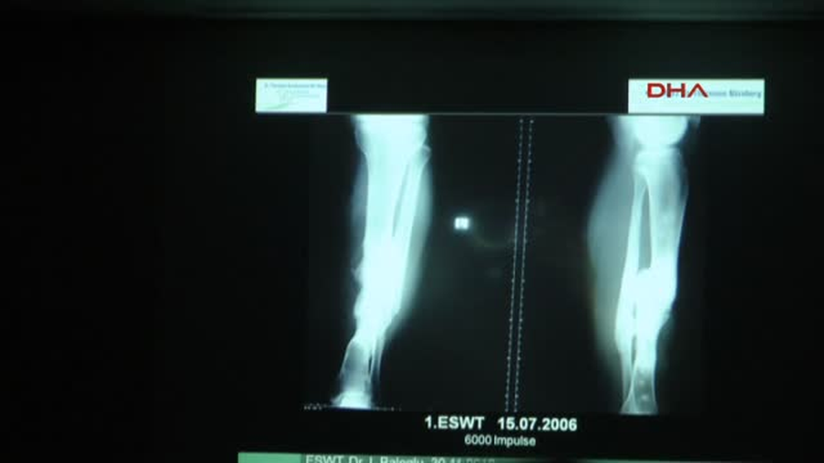 Türk Doktor Almanya\'nın Saygın Hastanelerinden St.theresien\'de Bölüm Başkanı Oldu