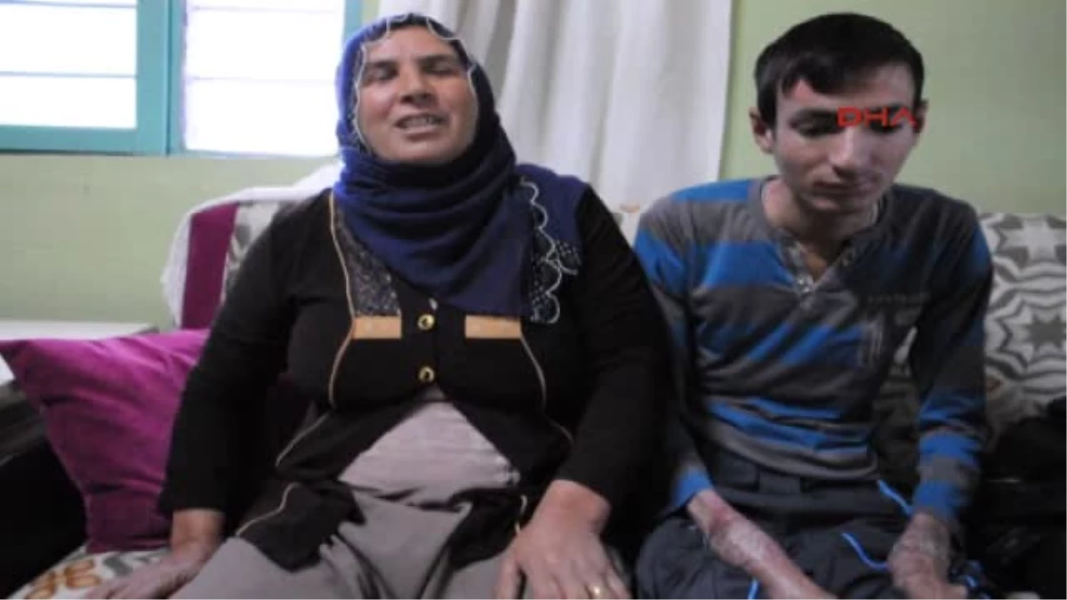 Diyarbakır Epidermolisis Bulloza Hastası Gencin Dramı Her Gün Biraz Daha Eriyor