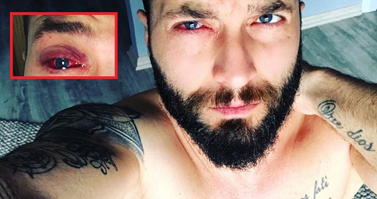 Berkay, Sağlık Problemi Yüzünden Konserini İptal Etti