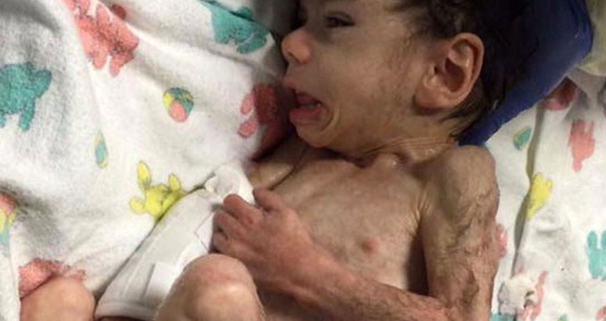 Açlıktan Ölmek Üzereyken Evlat Edinilen Çocuğun Mucize Değişimi