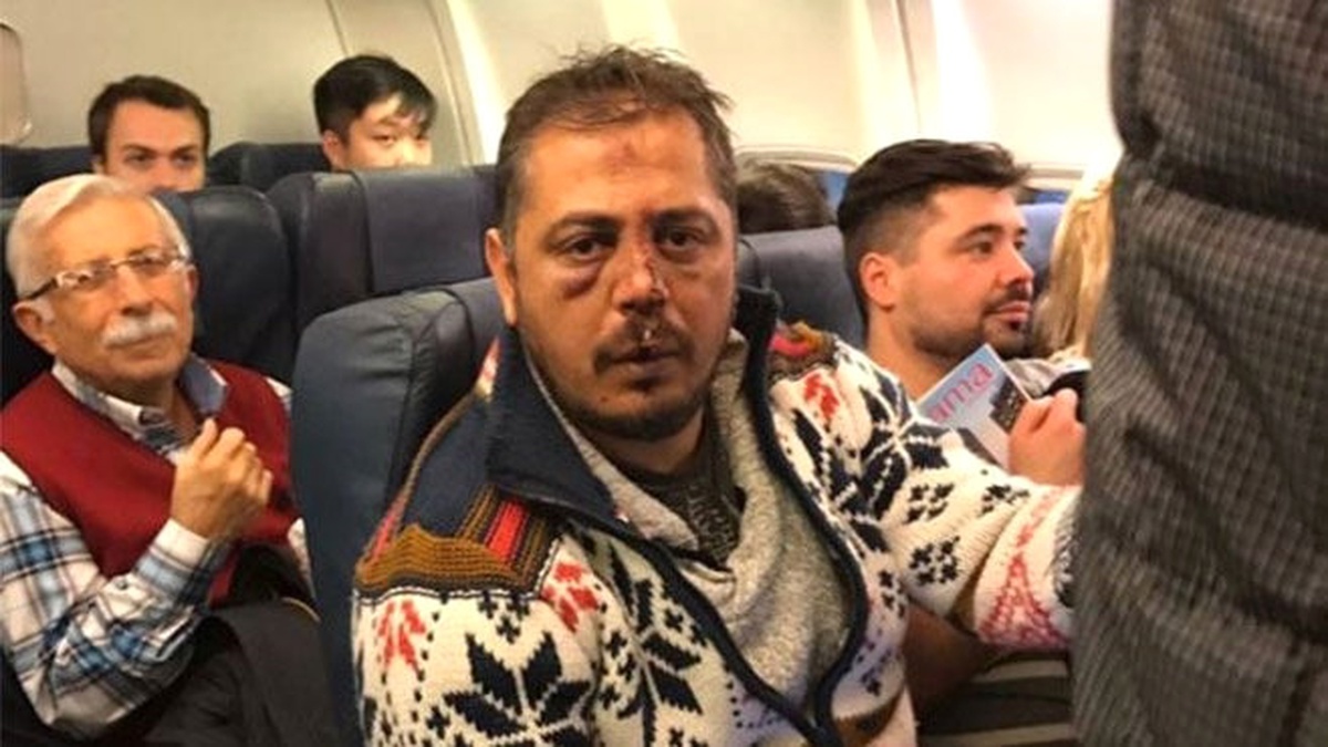 Kiev\'de Saldırıya Uğrayan Beşiktaş Taraftarı Yoğun Bakımda