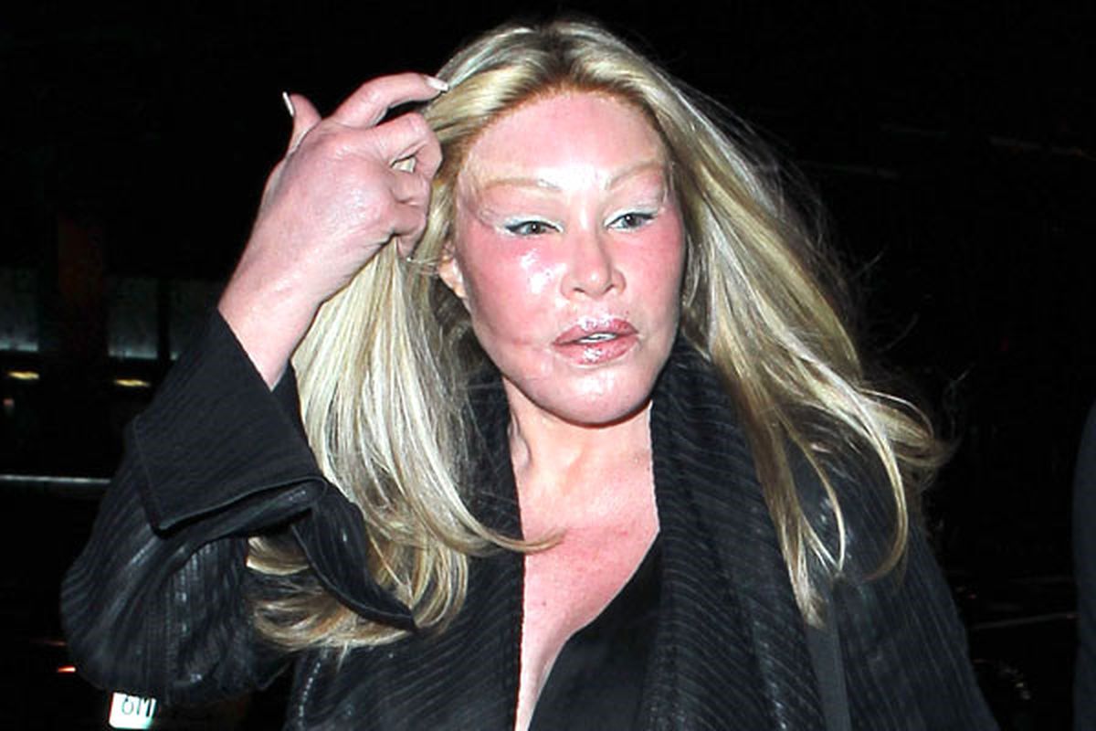 'Kedi Kadın' Jocelyn Wildenstein, Sevgilisinin Yüzüne Sıcak Mum Dökmüş