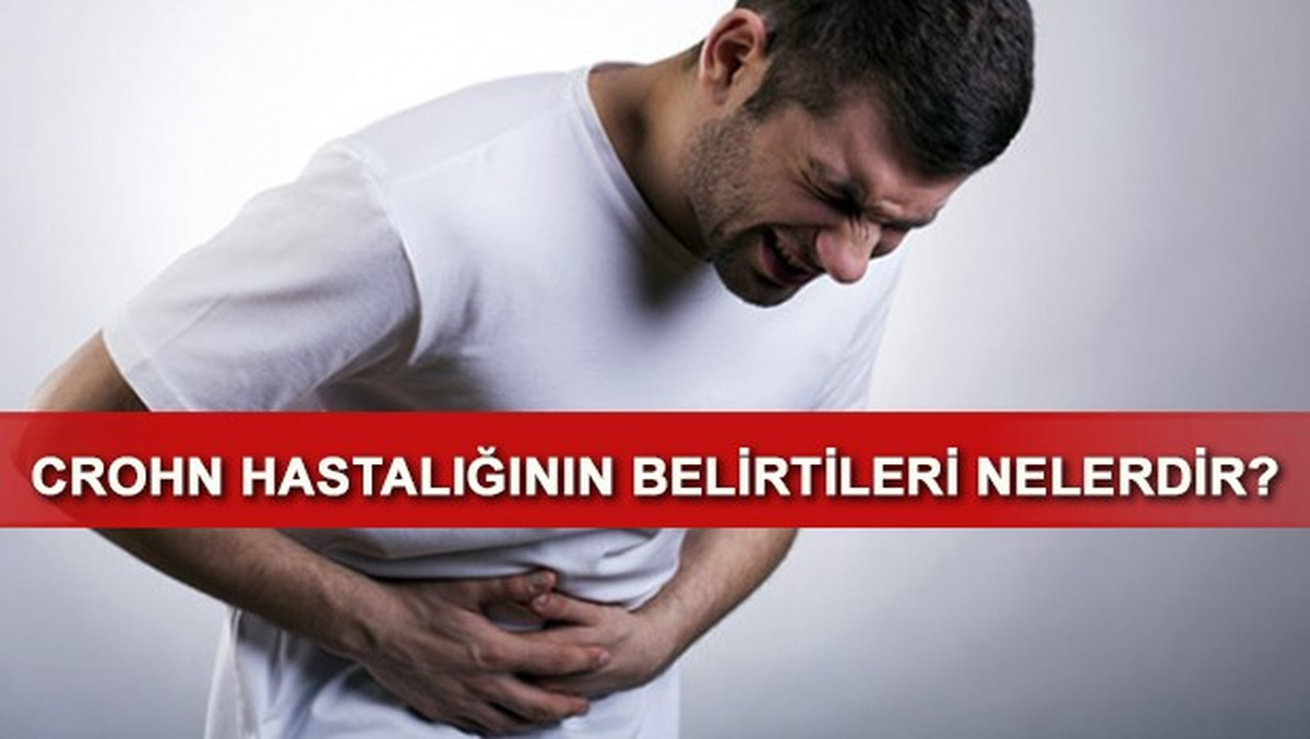 Crohn Hastalığı Nedir? Belirtileri Nelerdir?