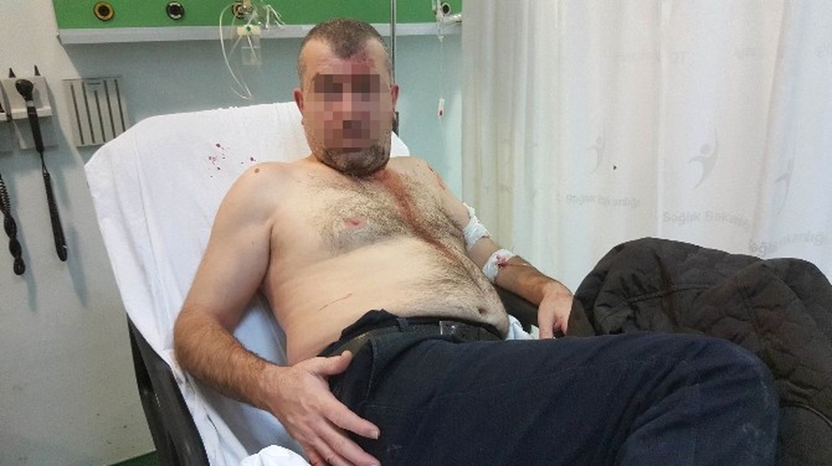 Dolmuş Şoförünün Bıçakladığı Yaya Hastanelik Oldu