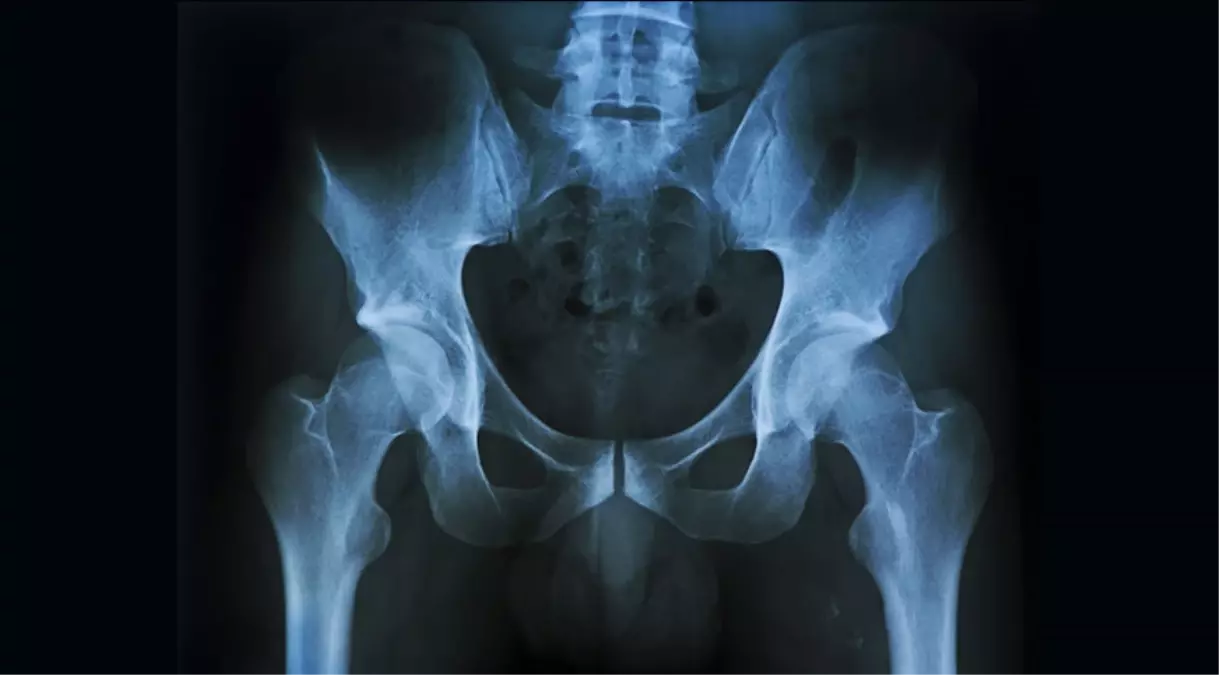 İnsanlarda Neden Penis Kemiği Yok?