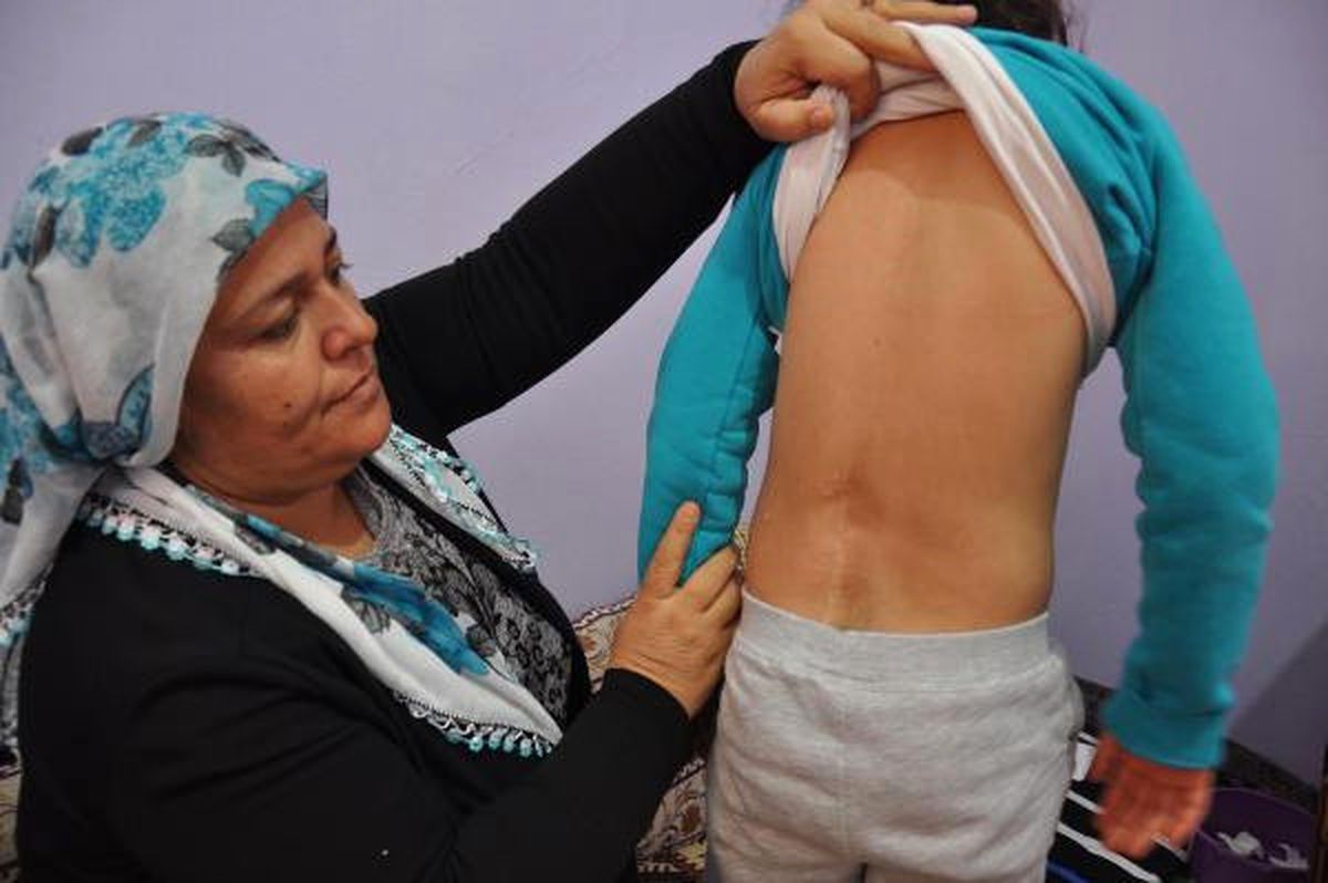 Kızlarının Ameliyatı İçin Evlerini Satılığa Çıkardılar