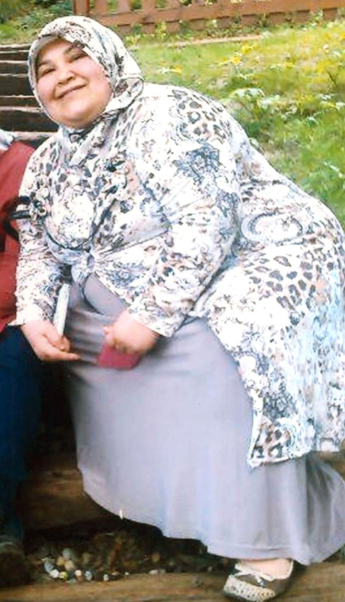 Robotik Cerrahi ile 75 Kilo Verdi, 2. Bebek Hasreti Sona Erdi