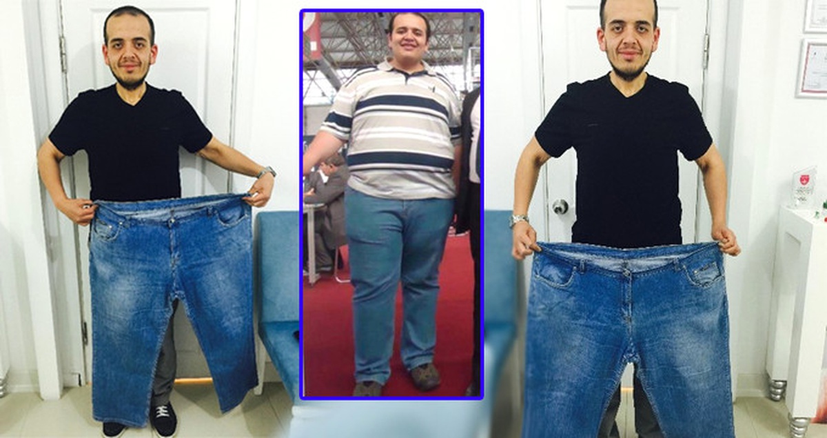 Kiloları MR Cihazına Fazla Geldi, Azimle 1 Senede 84 Kilo Verdi