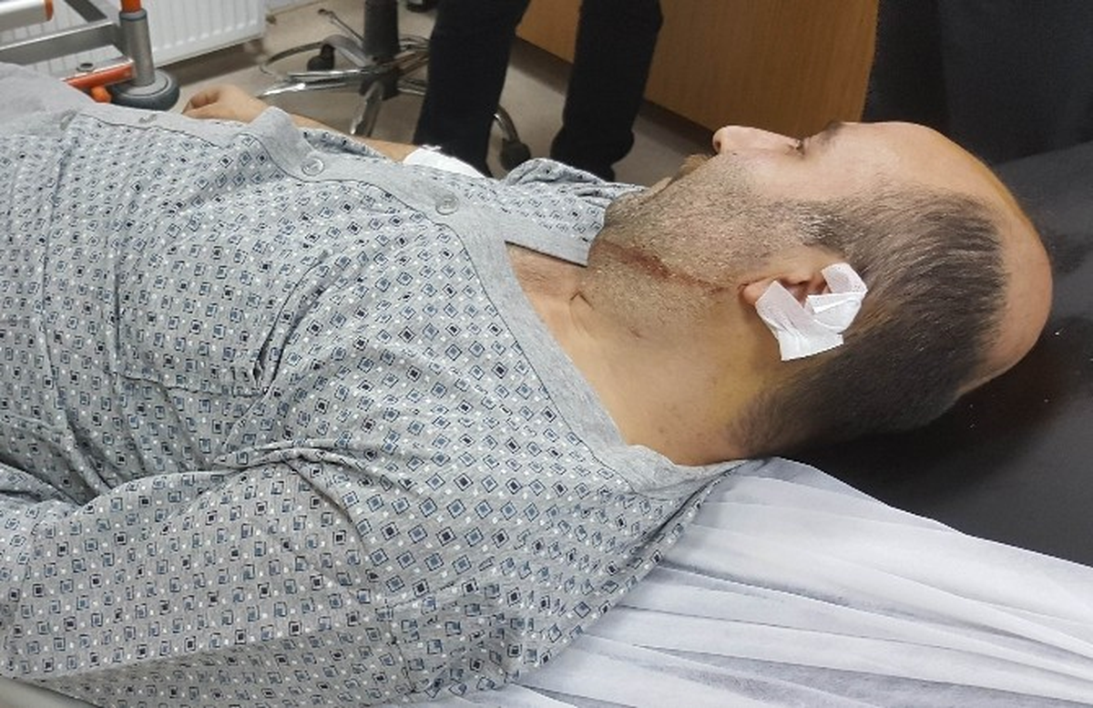 Silahlı Saldırıda Kazara Vuruldu