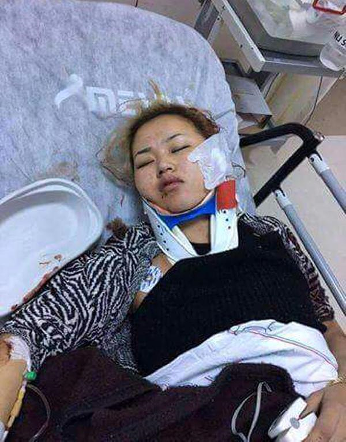 Antalya\'da Yabancı Uyruklu Kadını Dövüp, Yol Kenarına Attılar