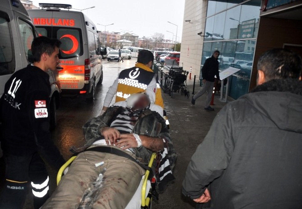 Kafası Banda Sıkışan İşçi Ağır Yaralandı