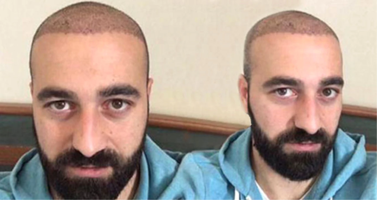 Erzurumspor\'da Fahri Tatan, Habersiz Saç Ektirince Takımdan Kovuldu