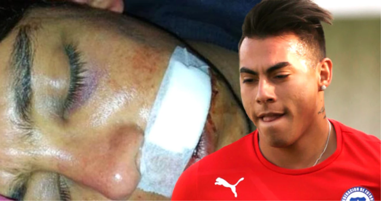 Polis, Şilili Futbolcu Eduardo Vargas\'ın Kardeşini Dövdü