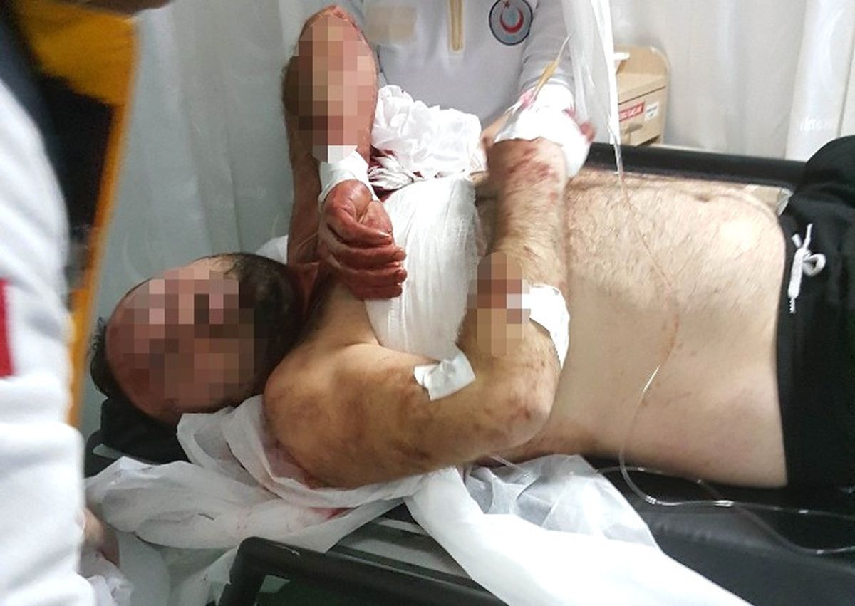 Samsun\'da Bıçaklı Saldırı: 2 Yaralı