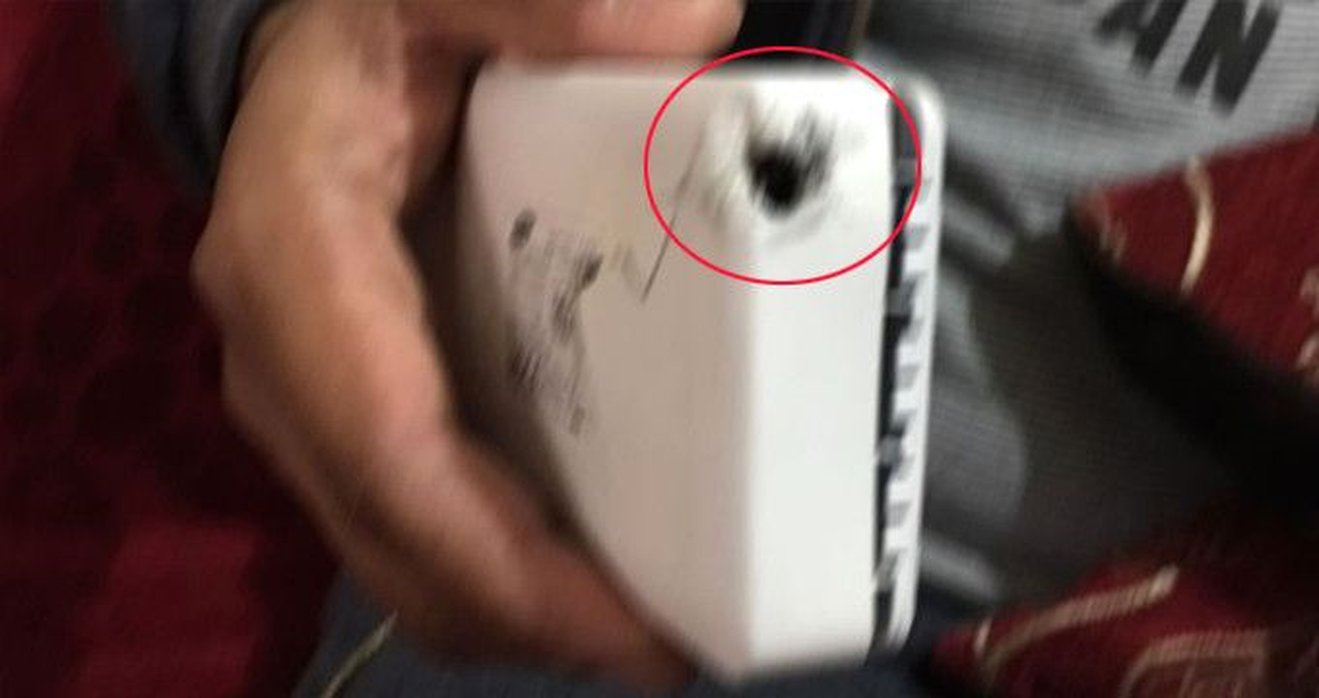 Ucuza Aldığı Taşınabilir Güç Kaynağı Bomba Gibi Patladı: Ağır Yaralı