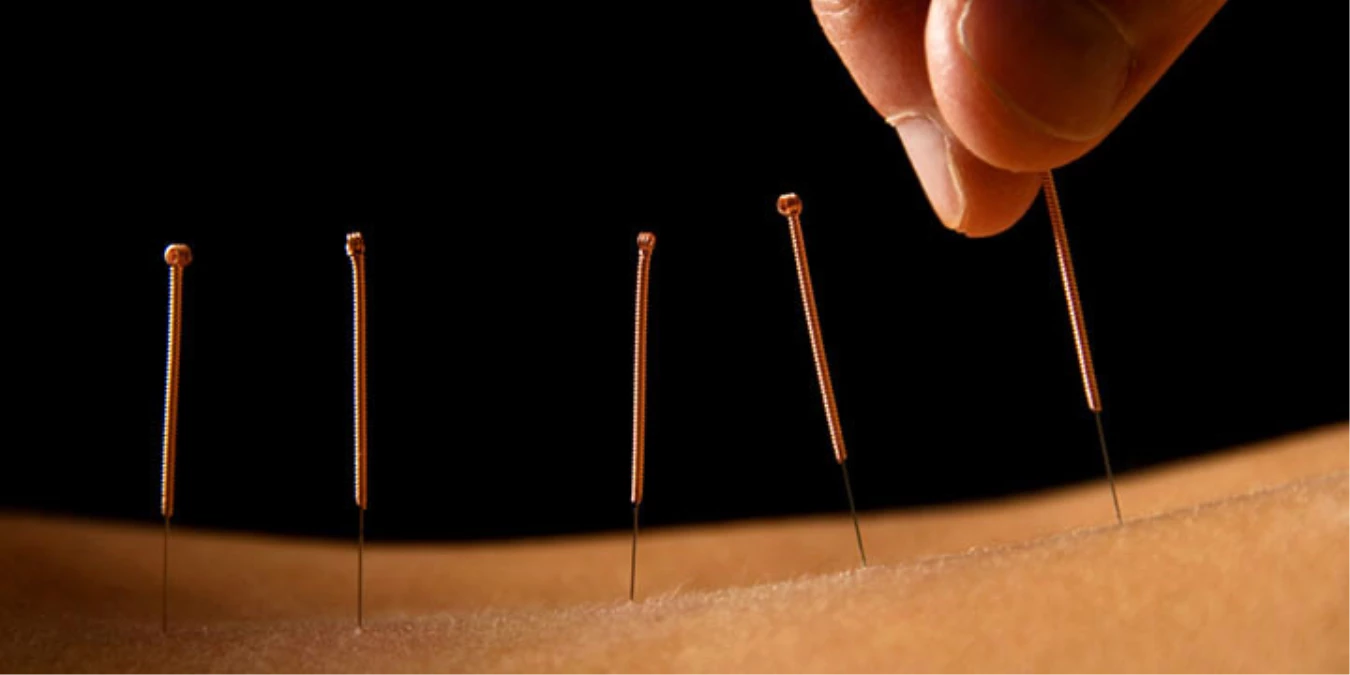 Psikiyatrik Akupunktur, Antidepresan Kullanımını Azaltıyor"