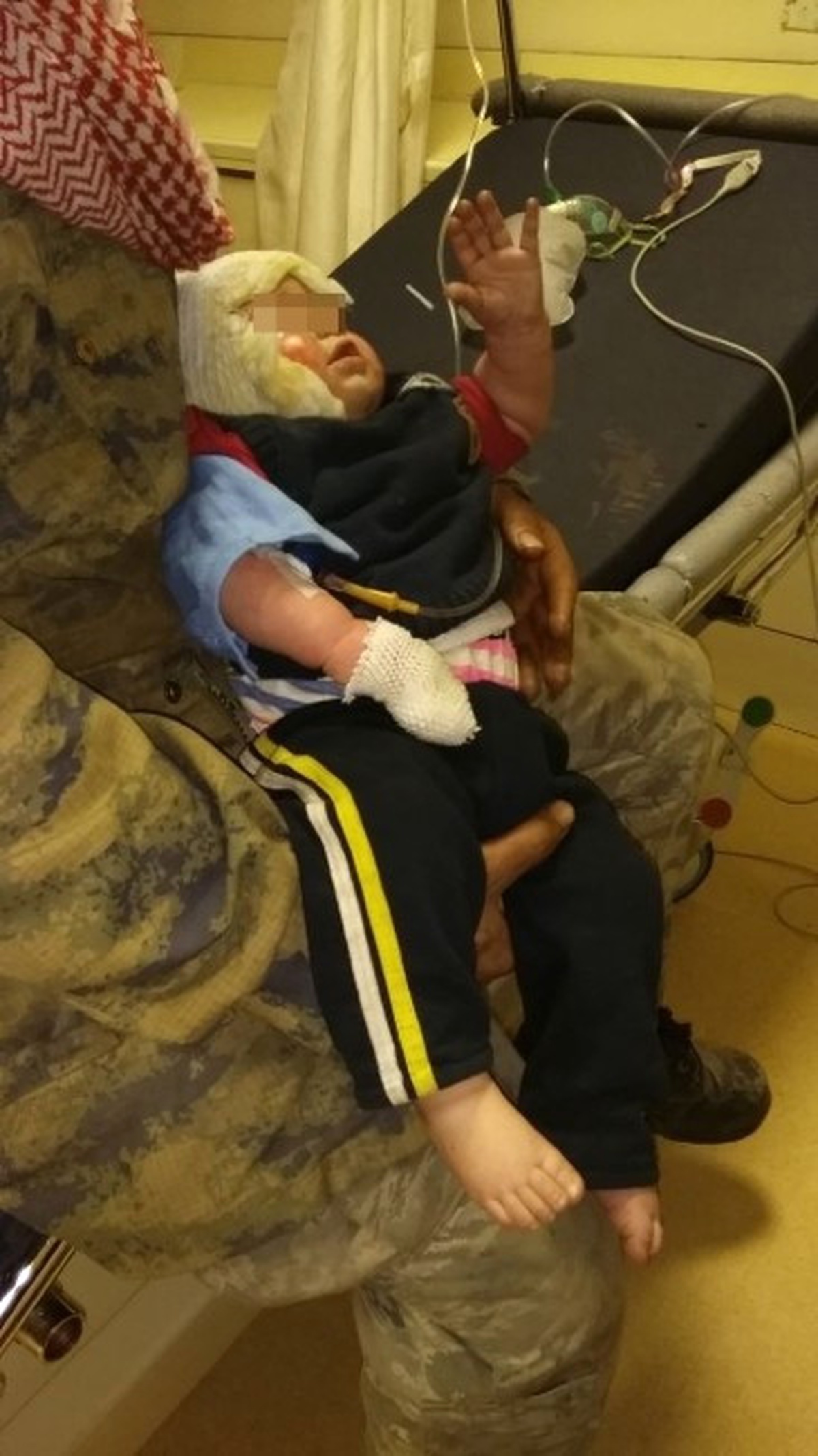 Sobayla Oynayıp Yangın Çıkaran Çocuk Kendisini ve 2 Kardeşini Yaktı